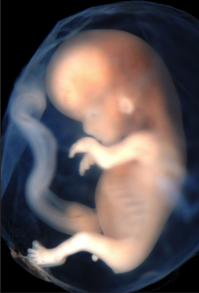 Foetus1.png