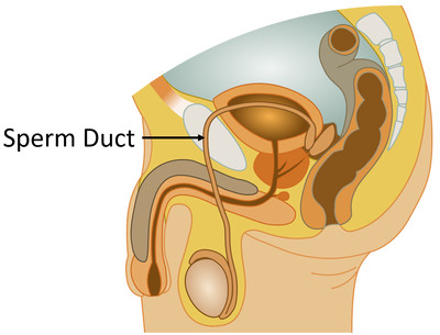 ReproductiveSystemSpermDucts.png