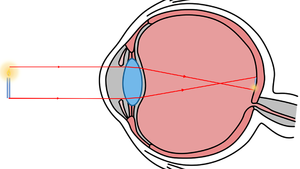 EyeImage.png