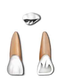 ToothIncisor.png